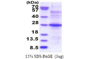 SDS-PAGE (SDS) image for POM121 and ZP3 Fusion (POMZP3) (AA 1-187) protein (His tag) (ABIN5853809)