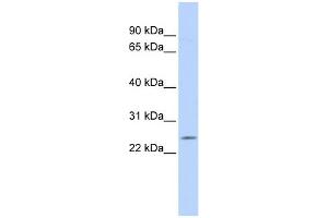 WB Suggested Anti-PSMB5 Antibody Titration: 0. (PSMB5 anticorps  (Middle Region))