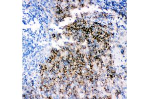 Anti- CD79B picoband antibody,IHC(P) IHC(P): Rat Spleen Tissue