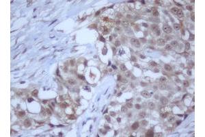 Image no. 14 for anti-DEAD (Asp-Glu-Ala-Asp) Box Polypeptide 59 (DDX59) (AA 1-303) antibody (ABIN1490728) (DDX59 anticorps  (AA 1-303))