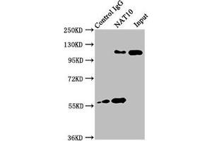 Immunoprecipitating NAT10 in Hela whole cell lysate Lane 1: Rabbit control IgG instead of ABIN7168283 in Hela whole cell lysate.