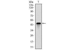 Western Blotting (WB) image for anti-Fast Skeletal Troponin I (TNNI2) antibody (ABIN1107197) (TNNI2 anticorps)