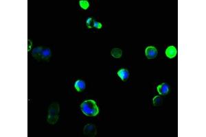 Immunofluorescence staining of MCF-7 cells with ABIN7161502 at 1:166, counter-stained with DAPI.