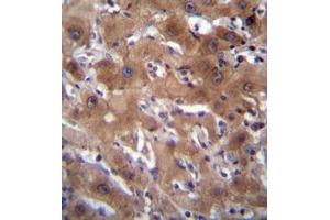 Formalin fixed, paraffin embedded human liver tissue stained with RASSF10 Antibody  followed by peroxidase conjugation of the secondary antibody and DAB staining. (RASSF10 anticorps  (Middle Region))