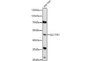 Western blot analysis of extracts of Rat liver, using SLC17 antibody (6642) at 1:1000 dilution.