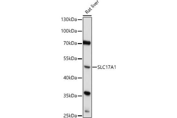 SLC17A1 Antikörper  (AA 1-100)