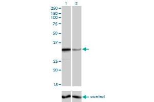 Western blot analysis of ZNF346 over-expressed 293 cell line, cotransfected with ZNF346 Validated Chimera RNAi (Lane 2) or non-transfected control (Lane 1). (ZNF346 anticorps  (AA 133-232))