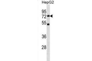 Western Blotting (WB) image for anti-SET Domain Containing 3 (SETD3) antibody (ABIN3001114) (SETD3 anticorps)