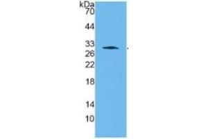 WB of Protein Standard: different control antibodies against Highly purified E. (Cathepsin K Kit ELISA)