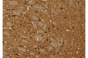 ABIN6269103 at 1/100 staining Rat brain tissue by IHC-P. (Progesterone Receptor anticorps)