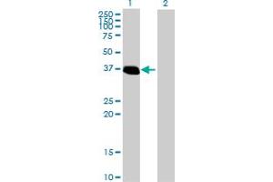 Western Blot analysis of ZNF444 expression in transfected 293T cell line by ZNF444 MaxPab polyclonal antibody. (ZNF444 anticorps  (AA 1-326))
