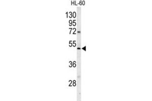 Western Blotting (WB) image for anti-Polymerase (DNA Directed), gamma 2, Accessory Subunit (POLG2) antibody (ABIN3001661) (POLG2 anticorps)