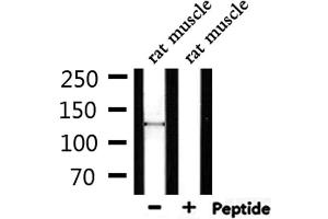 Western blot analysis of extracts from rat muscle, using SPZ1 Antibody.