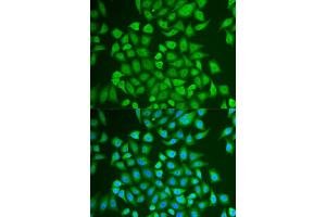 Immunofluorescence analysis of U2OS cells using PIP antibody (ABIN5973796). (PIP anticorps)