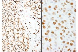Immunohistochemistry (IHC) image for anti-Splicing Factor Proline/glutamine-Ric (SFPQ) (AA 657-707) antibody (ABIN7454737)