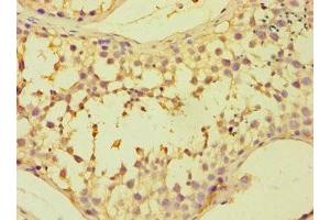 Immunohistochemistry of paraffin-embedded human testis tissue using ABIN7152381 at dilution of 1:100 (CAPZB anticorps  (AA 1-272))