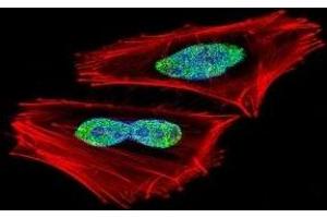 Fluorescent confocal image of A2058 cell stained with RBPJ antibody.
