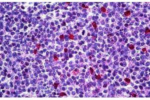 Human Tonsil: Formalin-Fixed, Paraffin-Embedded (FFPE)