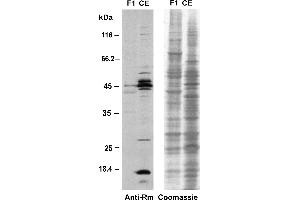 Western blot analysis of proteins from the eyespot fraction F1 and a CE with the anti-methyl-arginine specific antibody 7E6. (Methylated Arginine (MMA+ADMA+SDMA) anticorps)