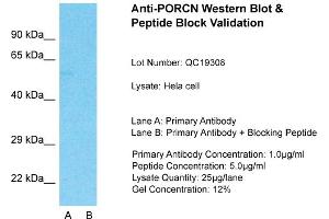 Host: Rabbit  Target Name: PORCN  Sample Tissue: Hela Whole cell  Lane A:  Primary Antibody Lane B:  Primary Antibody + Blocking Peptide Primary Antibody Concentration: 1 µg/mL Peptide Concentration: 5 µg/mL Lysate Quantity: 41 µg/laneGel Concentration:.
