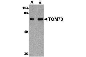 Image no. 1 for anti-Translocase of Outer Mitochondrial Membrane 70 (TOMM70A) (Internal Region) antibody (ABIN341714) (TOM70 anticorps  (Internal Region))