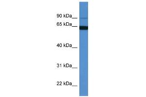 WB Suggested Anti-MAP6 Antibody Titration: 0. (MAP6 anticorps  (N-Term))
