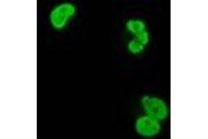 Anti-XRCC1 mouse monoclonal antibody (ABIN2453797) immunofluorescent staining of COS7 cells transiently transfected by pCMV6-ENTRY XRCC1 (RC204952). (XRCC1 anticorps)