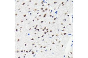 Immunohistochemistry of paraffin-embedded mouse brain using Cullin 3 antibody (ABIN7266543) at dilution of 1:100 (40x lens).