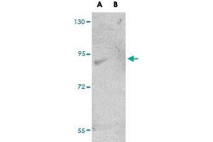 Western blot analysis of FAM59A in rat liver tissue lysate with FAM59A polyclonal antibody  at (A) 1 and (B) 2 ug/mL . (FAM59A anticorps  (C-Term))