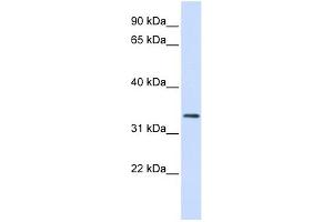 FBXO25 antibody used at 1 ug/ml to detect target protein.