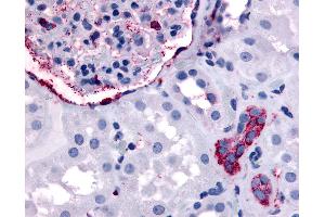 Anti-ERBB4 antibody IHC of human kidney.