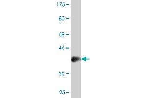 Western Blot detection against Immunogen (37.