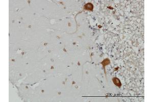 Immunoperoxidase of monoclonal antibody to FARSLB on formalin-fixed paraffin-embedded human cerebellum.