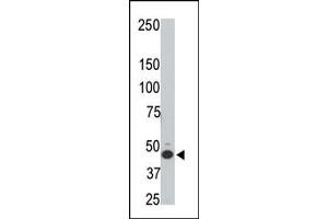 The anti-HtrA3 N-term Pab (ABIN1882095 and ABIN2846350) is used in Western blot to detect HtrA3 in rat testis tissue lysate.