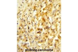 Immunohistochemistry (IHC) image for anti-NK3 Homeobox 1 (NKX3-1) antibody (ABIN3003998)