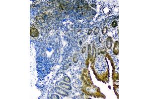 IHC analysis of Thioredoxin TRX using anti-Thioredoxin TRX antibody (ABIN6719381). (TXN anticorps  (AA 2-105))
