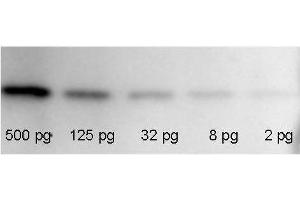 RFP Western Blot Kit: for RFP Chemiluminescent Western Blotting