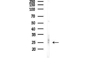 anti-EP300 Interacting Inhibitor of Differentiation 1 (EID1) (Internal Region) antibody