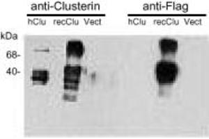 Western Blotting (WB) image for anti-Clusterin (CLU) antibody (ABIN7211558) (Clusterin anticorps)