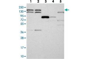 Western blot analysis of Lane 1: RT-4, Lane 2: U-251 MG, Lane 3: Human Plasma, Lane 4: Liver, Lane 5: Tonsil with DHX38 polyclonal antibody  at 1:250-1:500 dilution. (DHX38 anticorps)