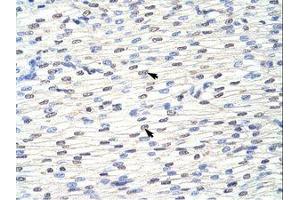 Image no. 1 for anti-Eukaryotic Translation Initiation Factor 4B (EIF4B) (AA 490-539) antibody (ABIN202813)