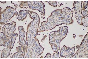 Immunohistochemistry of paraffin-embedded Human placenta using ANXA5 Polycloanl Antibody at dilution of 1:150