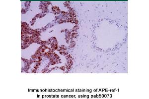 Image no. 2 for anti-Apurinic/Apyrimidinic Endonuclease 1 (APEX1) antibody (ABIN363379) (APEX1 anticorps)
