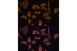 Immunofluorescence analysis of U-2 OS cells using EIF5B antibody (ABIN7267052) at dilution of 1:100.