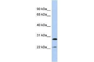 Host:  Rabbit  Target Name:  FGB  Sample Type:  MCF7 Whole Cell lysates  Antibody Dilution:  1. (Fibrinogen beta Chain anticorps  (Middle Region))