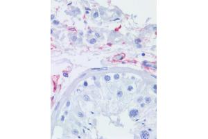 Immunohistochemistry staining of human testis (paraffin sections) using anti-CD271 (NGFR5). (NGFR anticorps)