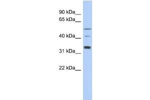 WB Suggested Anti-TCP11 Antibody Titration: 0. (TCP11 anticorps  (Middle Region))