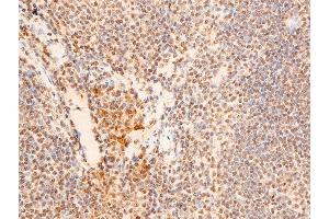 ABIN6267251 at 1/100 staining mouse spleen tissue sections by IHC-P.
