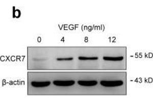 PDGFRα and PDGFRβ are essential for VEGF-induced CXCR7 expression in MSCs.