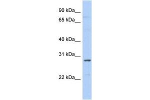WB Suggested Anti-SNRPA1 Antibody Titration:  0. (SNRPA1 anticorps  (N-Term))